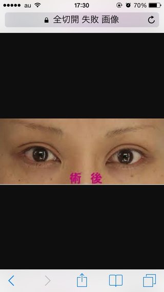 整形失敗したんだけど