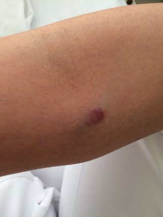 今日採血して絆創膏みたいなの貼られて