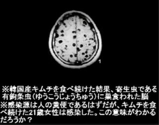 「韓国産」を「愛媛産」に　回転すし店チェーンの銚子丸が産地誤表記 