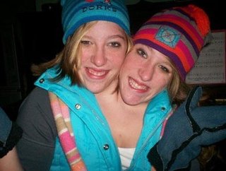 バングラデシュ・ブラーマンバリアの病院で頭部が二つある女児 