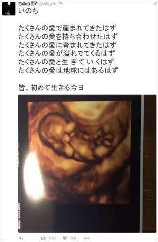 吉高由里子、Twitterに意味深ポエム＆胎児のエコー写真をUP