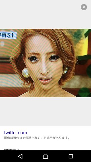 加藤紗里整形だと思いますか？