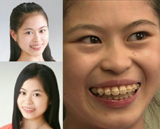 (トリプルアクセルが跳べない)宮原知子大っ嫌い(アンチ)