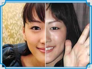 目元整形した人集合