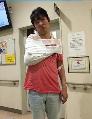 NONSTYLE石田、大阪の路上で転倒し骨折