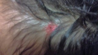 頭の傷なんだけど、縫合するかな？写メあるから、苦手な人は見ないで