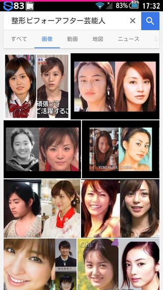 整形でかわり過ぎ芸能人