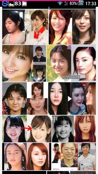 整形でかわり過ぎ芸能人