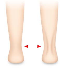 足首がキュッてしてる人は妊娠しやすいんだって