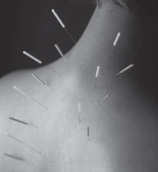 偏頭痛の人、今日どう？