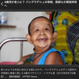 4歳児が老人に？ バングラデシュの奇病、医師らが原因究明へ