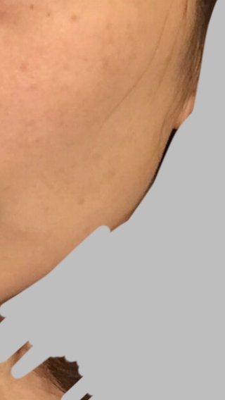 こまかくて薄いシミ。汚いけど写あり