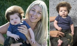 ”剛毛”過ぎる生後9週間の赤ちゃんが話題に！