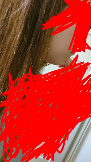 しゃくれって骨が出てるの？