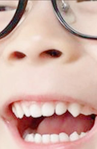 双子の りんか あんな ちゃん