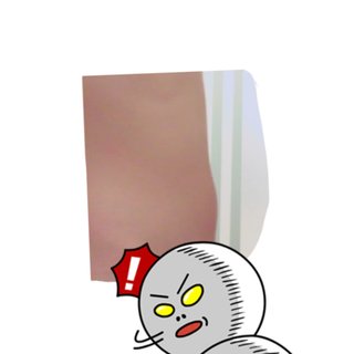 拒食症→胃下垂(？)→過食症→便秘