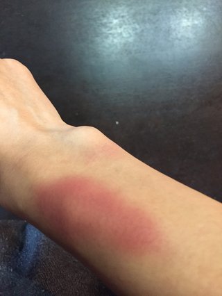 DVで病院って程度？