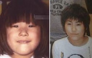 整形でかわり過ぎ芸能人