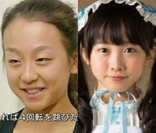 本田真凜ちゃんみたいに小さい頃ブスで成長と共に綺麗になってチヤホヤされ出した人