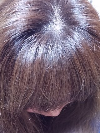 私ハゲてますよね？【写】