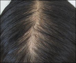 私ハゲてますよね？【写】