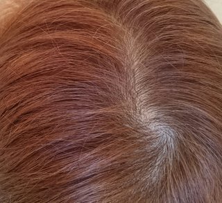 私ハゲてますよね？【写】