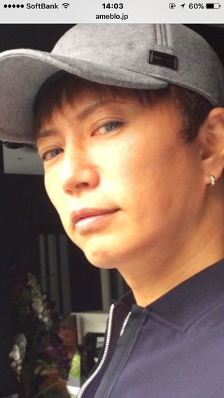 GACKTの元愛人が「首吊り自殺」未遂