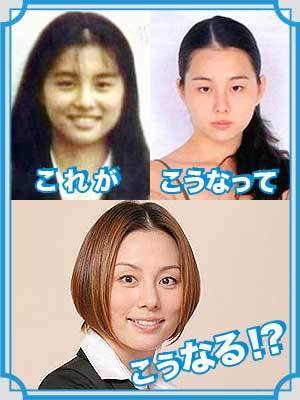 整形でかわり過ぎ芸能人