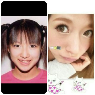 整形でかわり過ぎ芸能人