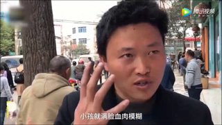 【動画】サムスン製のスマホが爆発し5歳女児が顔面やけど　傷が残る可能性大