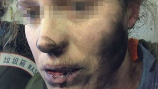 飛行機内で使用中のヘッドフォンが爆発　使用していた女性が負傷【オーストラリア】