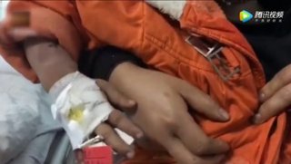 【動画】サムスン製のスマホが爆発し5歳女児が顔面やけど　傷が残る可能性大