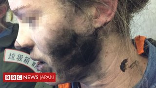 飛行機内で使用中のヘッドフォンが爆発　使用していた女性が負傷【オーストラリア】