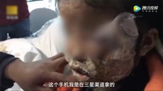 【動画】サムスン製のスマホが爆発し5歳女児が顔面やけど　傷が残る可能性大