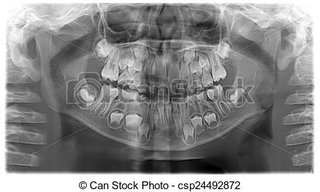 ペンギンの口の中…