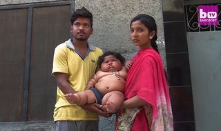 生後8か月で体重17.2kg　日々重くなっていくインドの女児 