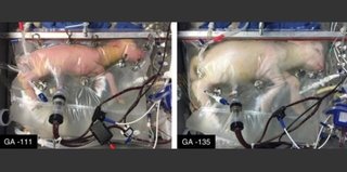 超未熟児向け人工子宮、ヒツジ胎児が正常発育 米研究