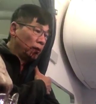 ユナイテッド航空が過剰予約　アジア人だけを選び強制的に引きずり降ろし＆暴行というとんでもない事態