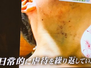 小１男児に虐待 神奈川 伊勢原市、学童保育代表