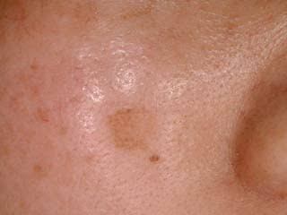 なにかしら美容皮膚科利用してる人