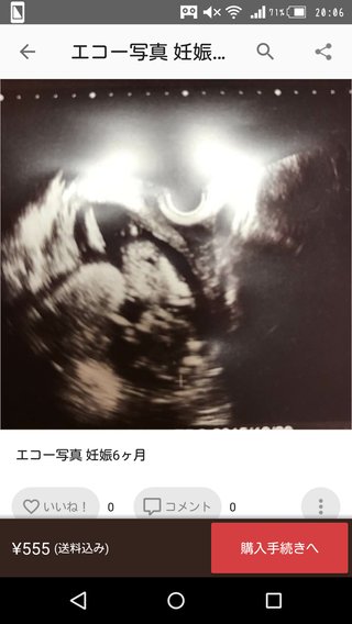 メルカリにエコー写真