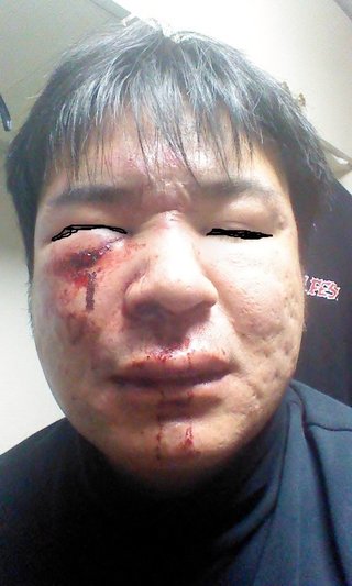 安倍チルドレン「豊田真由子」代議士の“絶叫暴行”を秘書が告発