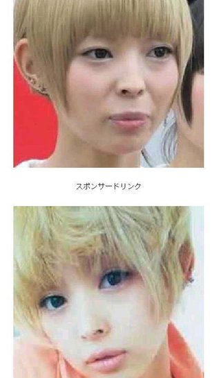 整形でかわり過ぎ芸能人