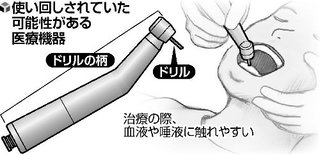 歯削る医療機器、半数使い回し…院内感染の恐れ 歯科医療