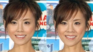 高橋真麻の鼻を治したら