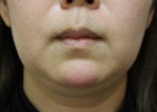 みんな口元写真撮ってみて！