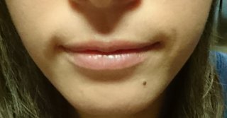 みんな口元写真撮ってみて！