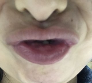 みんな口元写真撮ってみて！