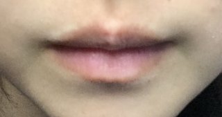 みんな口元写真撮ってみて！