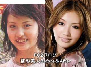 鈴木えみ